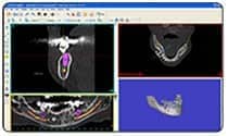 3d CAT scan - oral surgery image