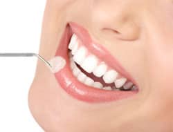 lumineers emprethin dental veneer