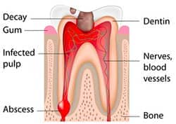 Chandler Dentist - root canal cross section illustration